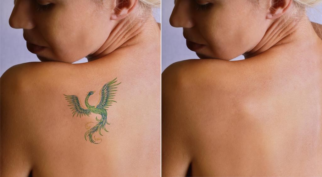 Top 6 Best Cover Up Tattoo Ideas